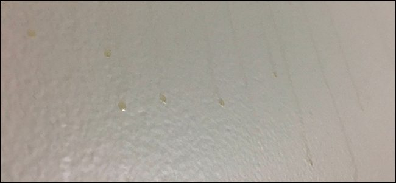 Quelles sont ces taches brunes brutes sur les murs de ma salle de bain?